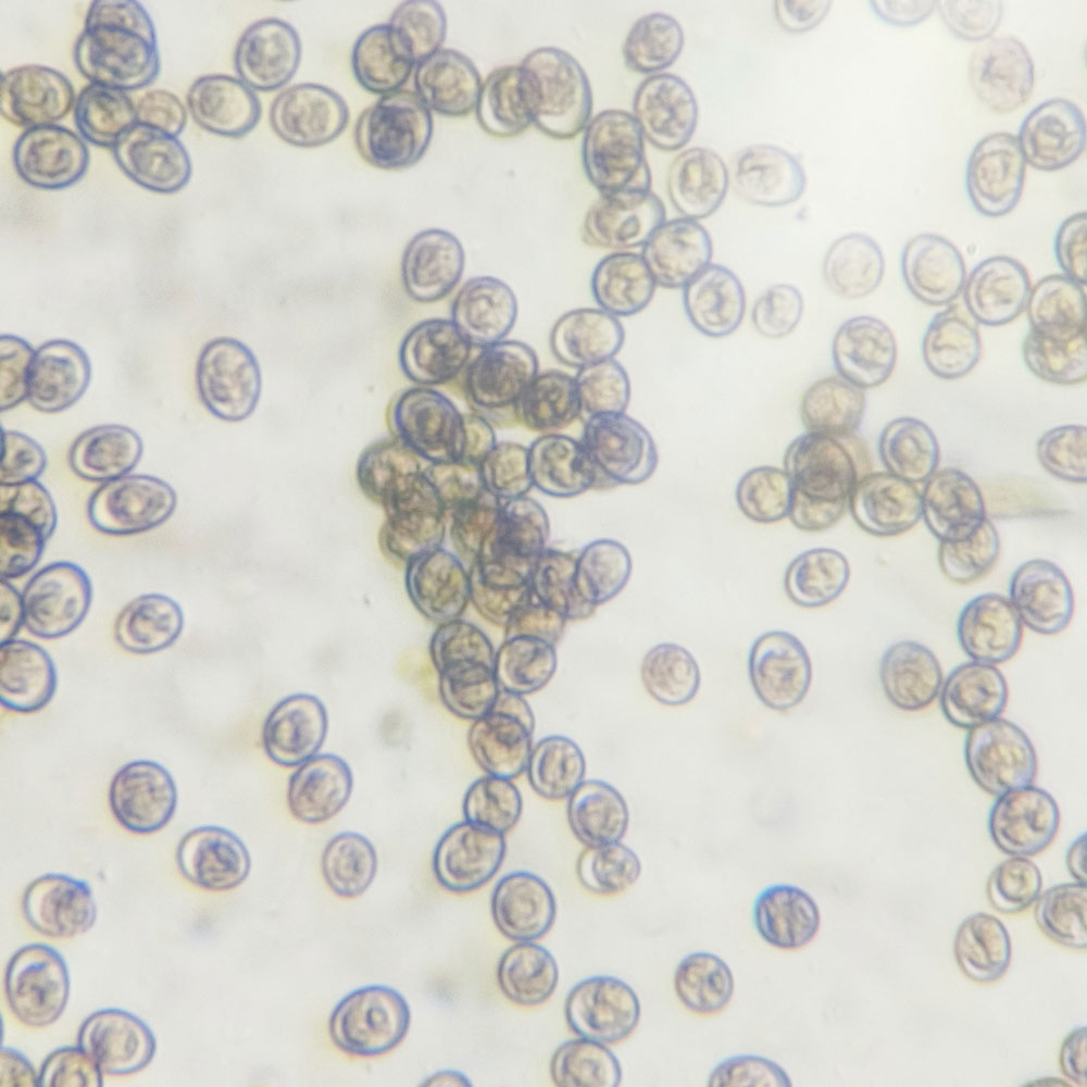 Microscopic view of coccidia oocysts.